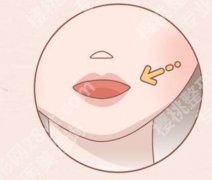 注射伊妍仕少女针会肿么？适合注射的部位和注意事项盘点