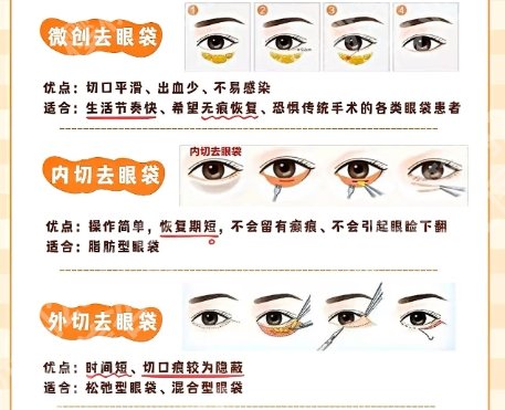 北京八大处去眼袋多少钱？医生擅长项目信息介绍！