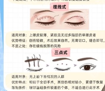 襄阳割双眼皮比较好的医院！医院实力上榜！项目丰富