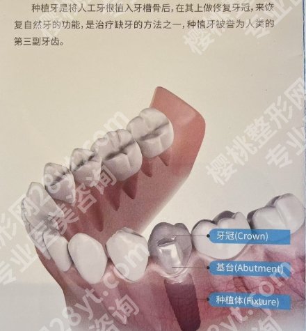淮安种植牙医院排行名单来了！来看看有没有你心仪的医院！