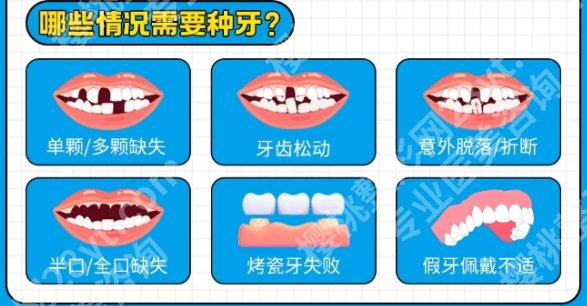 哈尔滨牙齿种植那个医院？分享医院详细资料！且看且珍惜