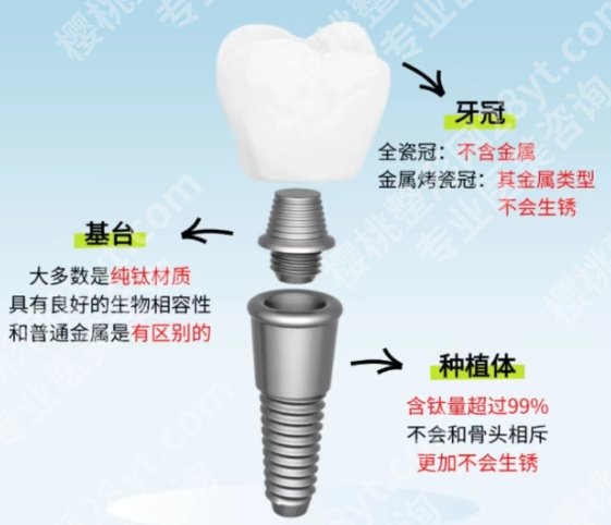 泰州种牙哪家医院好？医院项目种类多环境好！收藏再看