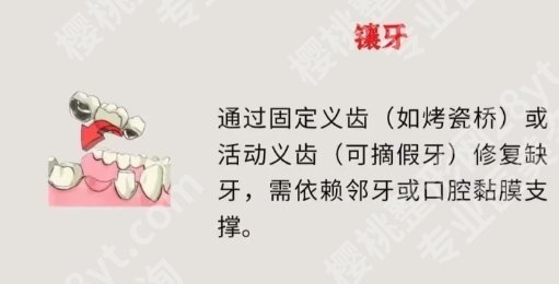 蚌埠镶牙哪家医院好？来看看有没有你心仪的医院吧！
