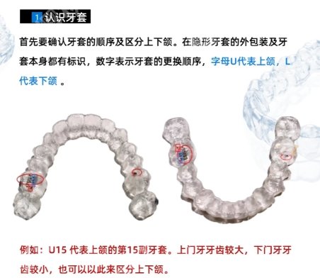 东莞戴牙套哪个医院好？东莞市人民医院|东部中心等医院技术实力靠谱！
