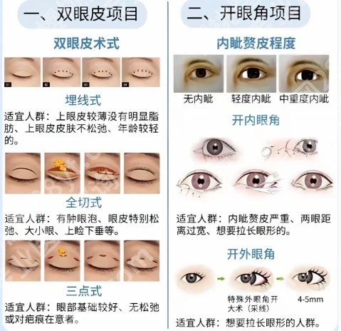 黄冈割双眼皮哪个医院好？推荐几家技术不错的医院！