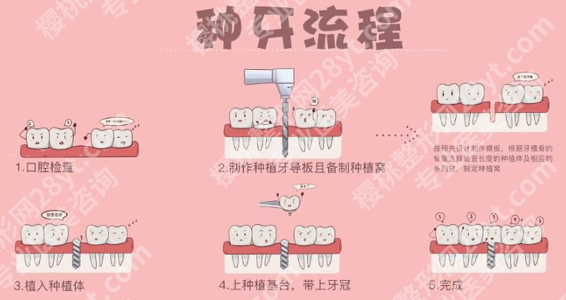 无锡牙齿种植哪家医院好一点？医院实力强大|开展项目种类多！