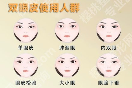 聊城割双眼皮正规医院有哪些？一起来看医院详细介绍！
