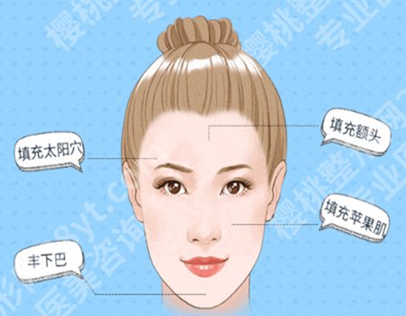 易成刚自体脂肪填充怎么样？自体脂肪填充案例反馈，项目科普解答
