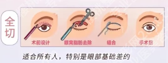 常德割双眼皮哪里好？医院的详细资料！且看且珍惜