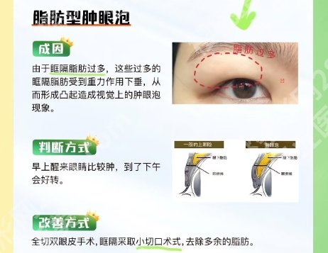 昆明割双眼皮好的医院2025年名单来了！医院具体资料信息！