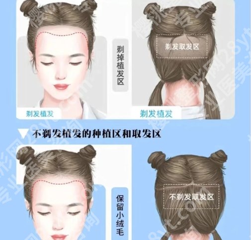 盐城植发机构排行榜前十名榜单更新！个个实力在线！