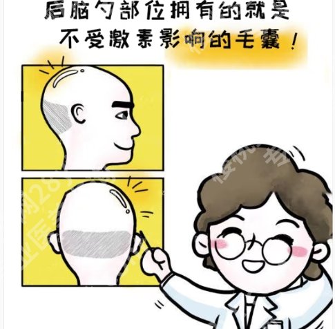 大庆植发医院哪家医技术好？大庆油田总医院|大庆市人民等医院都很有实力！