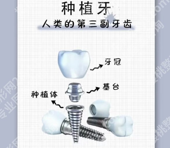 镇江牙齿种植医院排名更新啦！医院基本信息详细介绍！