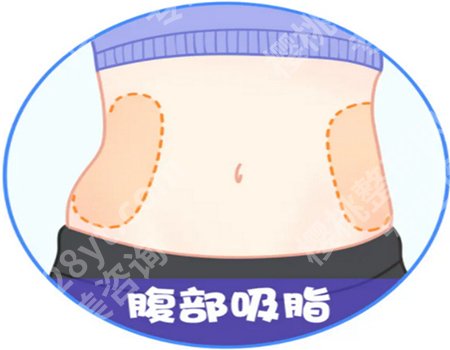 孝感中心医院抽脂好吗？价格多少？抽脂案例分享，吸脂价格从4900元起