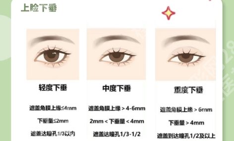 宜昌割双眼皮哪里好？宜昌市中心人民医院|华美整形美容等医院技术靠谱！