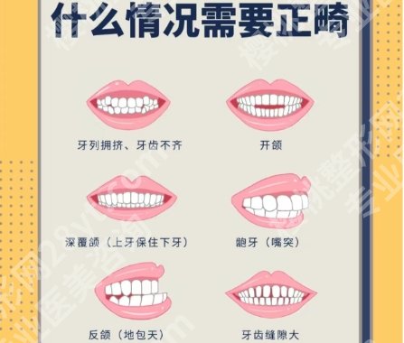 苏州正畸医生哪些技术好呢？医生技术精湛|经验丰富！