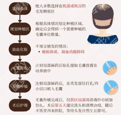大同植发多少钱？哪家好？大同市第三医院|熙朵植发医院等都是很不错的选择！