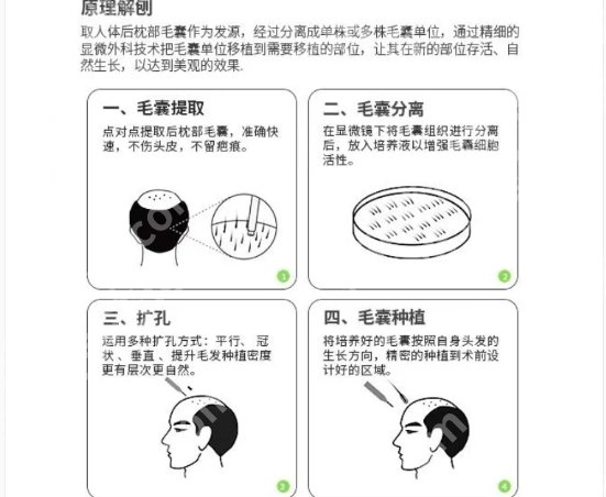 温州植发医院哪家医技术好？医院具体信息介绍！