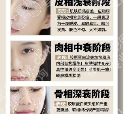 浙一医院筋膜提升术多少钱？2025收费明细参考！戳进来看
