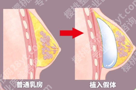 万连壮教授手术技术怎么样？医生有着自己的特色和实力！