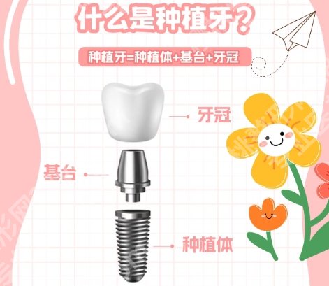 淄博牙齿种植哪家好？淄博市中心医院|妇幼保健院等医院都是不错的选择！