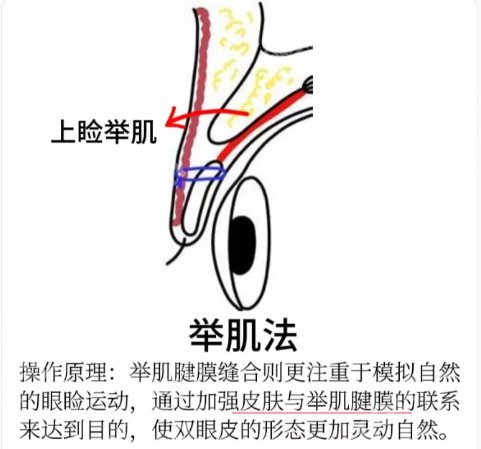 南京割双眼皮比较好的医院名单揭秘！医院简介以及顾客点评！