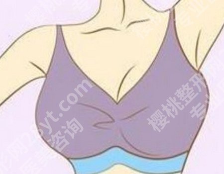 深圳自体脂肪丰胸技怎么样？费用大揭秘