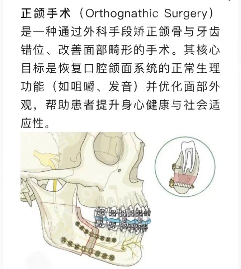 广医一附院正颌手术价格大概多少？医院实力超群！且看且珍惜