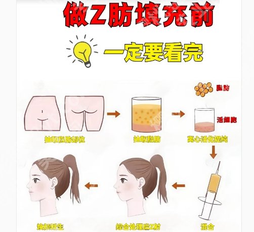 新华医院脂肪填充怎么样？新华医院有着很强的实力水平！