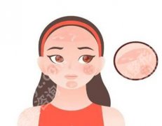 做筋膜提升后会不会加速衰老？这3个误区要避开