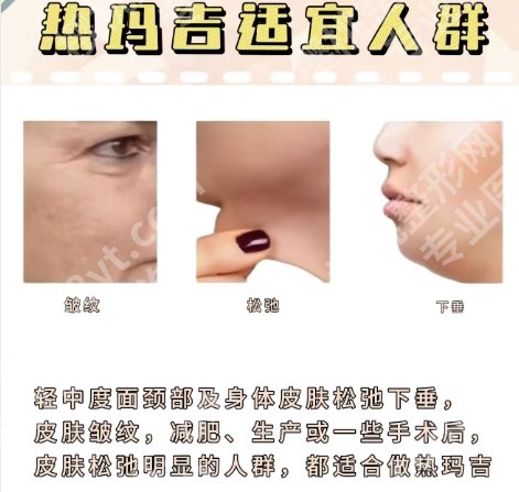 浙一医院热玛吉多少钱？费用一般都是9800元左右起！收藏再看