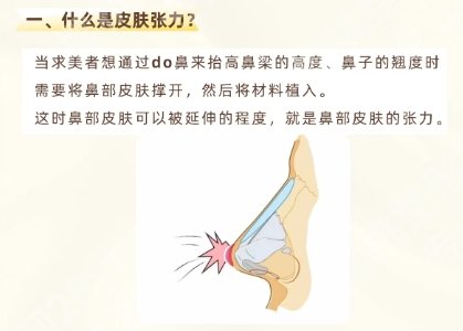西京医院做鼻子怎么样？医院项目推荐！分享真实案例