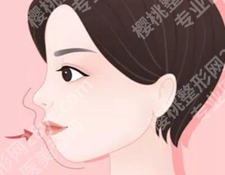 丰唇针的副作用真有那么可怕？丰唇项目的利弊都说清楚了
