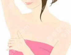 告别“负担”：缩乳手术全解析，从原理到步骤一看就懂