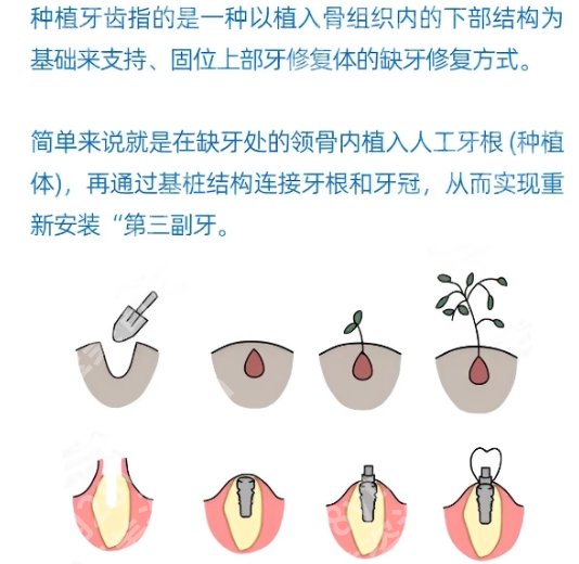 同济大学附属口腔医院和九院哪个好？医院详细介绍！