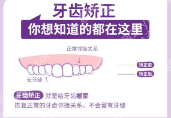 2025北大口腔牙齿矫正怎么样？医院项目技术相当突出！