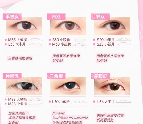 惠州割双眼皮多少钱？医院参考价格是9984元起！收藏再看