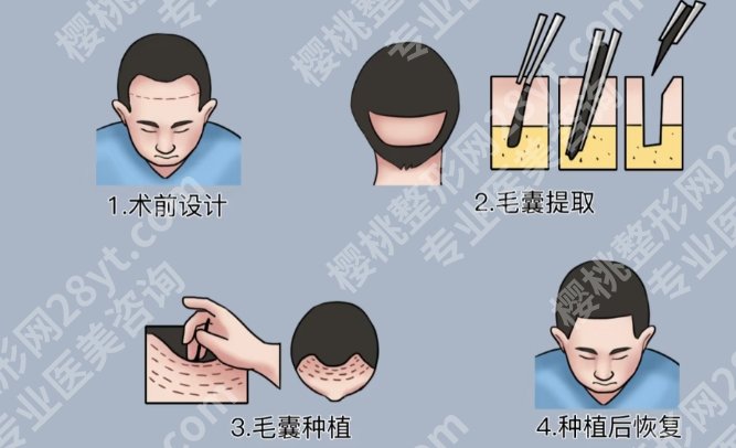 南京植发正规医院排名名单！这些医院都是实力上榜的机构！一起来看看吧