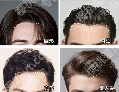 沧州植发多少钱？推荐几家不错的医院！收藏再看