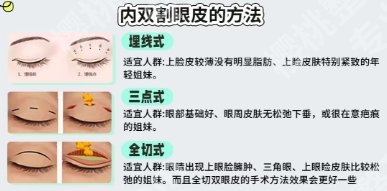 长春割双眼皮哪家医院比较好？医实力在线查看！