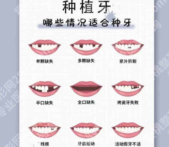 赣州牙齿种植哪家好？医院具体介绍！速速浏览细节