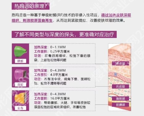 成都美莱做热玛吉怎么样？医院擅长核心项目信息！