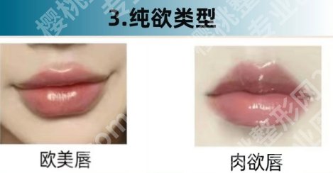 嘉兴嘟嘟唇丰唇要多少钱？参考费用一般都是2980元到21,000元之间！