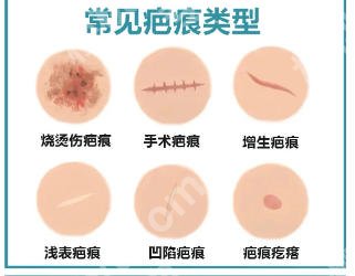 上海九院去疤痕挂什么科？医院实力不容小觑！