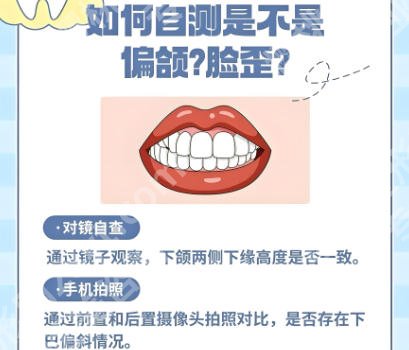南京吴国平偏颌手术怎么样？一键了解医生具体详情！