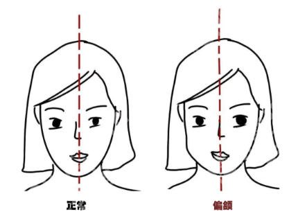 南京吴国平偏颌手术怎么样？一键了解医生具体详情！