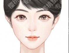筋膜悬吊和拉皮手术哪个更好？真人案例带你看差别