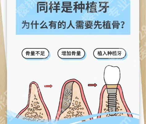赣州种牙哪家医院好？一键获取医院口碑名单！