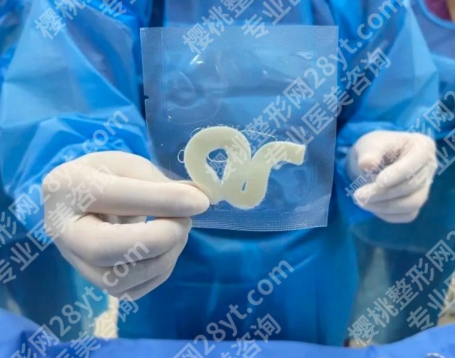 生物束带紧缩术后多久可以同房？恢复期是投资，越稳后面越赚