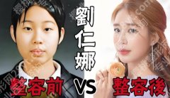 刘仁娜整容前后怎么样？旧照对比+医美细节拆解，真相一目了然